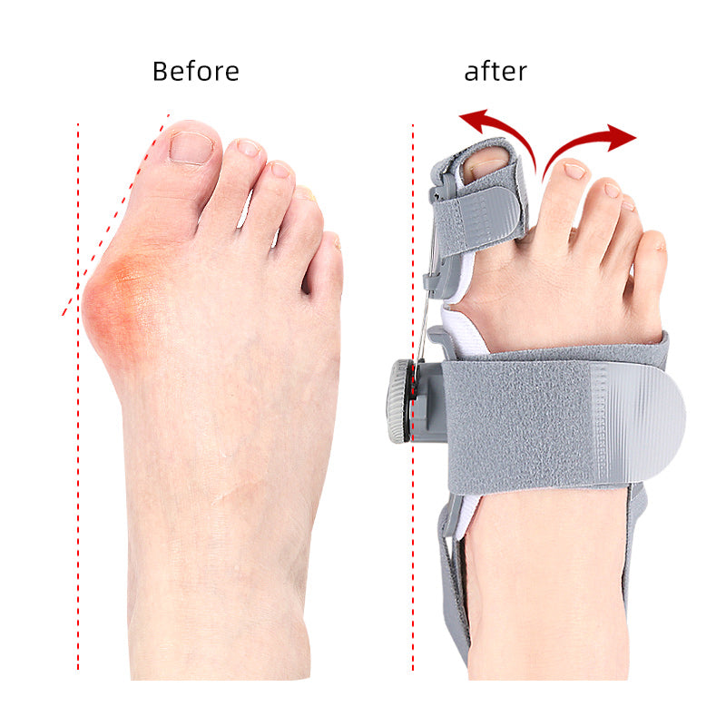 PiedZen™  - Correcteur Hallux Valgus | Soulagement Douleur & Redressement du Gros Orteil
