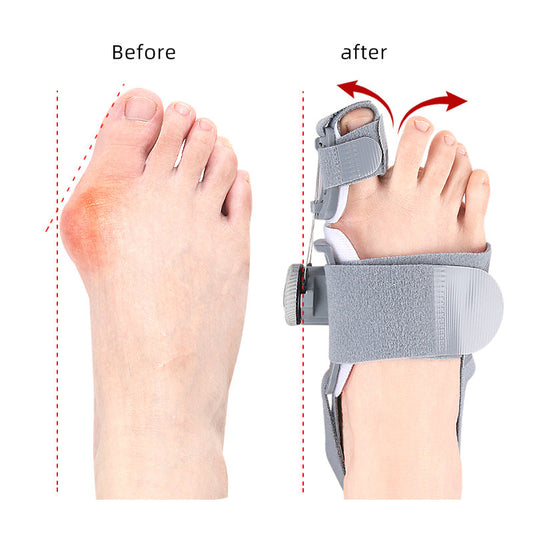 PiedZen™  - Correcteur Hallux Valgus | Soulagement Douleur & Redressement du Gros Orteil